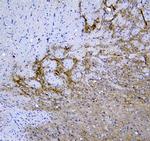 Synaptotagmin 1 Polyclonal Antibody