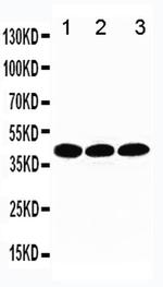 TBP Polyclonal Antibody