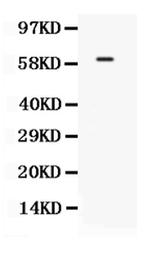 TCF7L1 Antibody in Western Blot (WB)