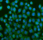 TCP1 Polyclonal Antibody