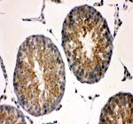 TCP1 Antibody in Immunohistochemistry (Paraffin) (IHC (P))