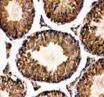 TCP1 Antibody in Immunohistochemistry (Paraffin) (IHC (P))