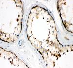 TCP1 Antibody in Immunohistochemistry (Paraffin) (IHC (P))