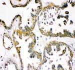 TCP1 Antibody in Immunohistochemistry (Paraffin) (IHC (P))