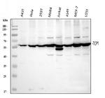 TCP1 Antibody in Western Blot (WB)