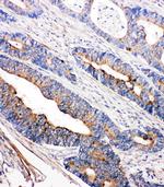 TEC Polyclonal Antibody