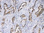 TECTA Polyclonal Antibody