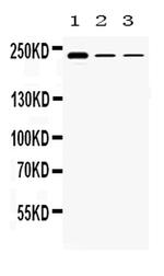 TECTA Antibody in Western Blot (WB)