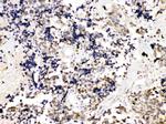 TRF2 Polyclonal Antibody