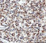 TFAM Antibody in Immunohistochemistry (Paraffin) (IHC (P))