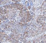 TFAM Antibody in Immunohistochemistry (Paraffin) (IHC (P))