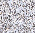 TFAM Antibody in Immunohistochemistry (Paraffin) (IHC (P))