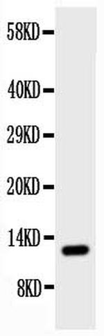 TFF1 Antibody in Western Blot (WB)