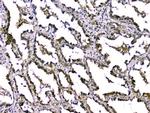 TGF beta-2 Polyclonal Antibody