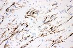 Tyrosine Hydroxylase Antibody in Immunohistochemistry (Paraffin) (IHC (P))