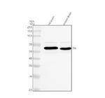 Tyrosine Hydroxylase Antibody in Western Blot (WB)