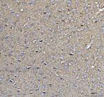 CD90 Antibody in Immunohistochemistry (Paraffin) (IHC (P))