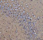 CD90 Antibody in Immunohistochemistry (Paraffin) (IHC (P))