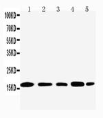 TIA-1 isoform p40 Polyclonal Antibody
