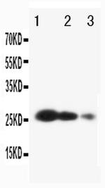 TIMP3 Polyclonal Antibody