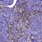 Talin 1 Antibody in Immunohistochemistry (Paraffin) (IHC (P))