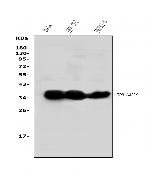 TNFAIP1 Antibody in Western Blot (WB)