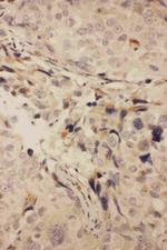 RANK (CD265) Polyclonal Antibody
