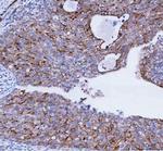 TACI Antibody in Immunohistochemistry (Paraffin) (IHC (P))