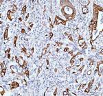 TACI Polyclonal Antibody