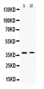 TNFRSF14 (HVEM) Polyclonal Antibody