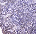 BCMA Polyclonal Antibody