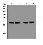 BCMA Polyclonal Antibody