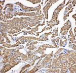 Cardiac Troponin C Polyclonal Antibody