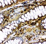 p73 Polyclonal Antibody