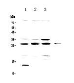 TPMT Polyclonal Antibody