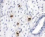 Tryptase Antibody in Immunohistochemistry (Paraffin) (IHC (P))