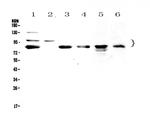 TPX2 Polyclonal Antibody