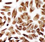 TRAM1 Polyclonal Antibody