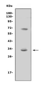 TREML1 Polyclonal Antibody