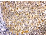 TRIB2 Polyclonal Antibody