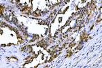 TIF1 gamma Antibody in Immunohistochemistry (Paraffin) (IHC (P))
