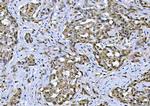 TIF1 gamma Antibody in Immunohistochemistry (Paraffin) (IHC (P))