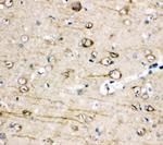 TRPC3 Polyclonal Antibody