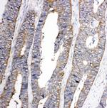 TRPC3 Antibody in Immunohistochemistry (Paraffin) (IHC (P))