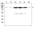 TRPC3 Antibody in Western Blot (WB)