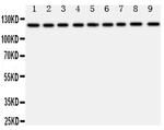TRPC3 Antibody in Western Blot (WB)