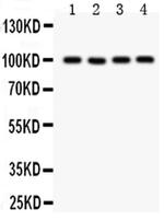 TRPC7 Polyclonal Antibody