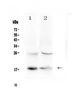 TSLP Polyclonal Antibody