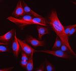 beta-5 Tubulin Polyclonal Antibody