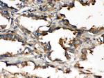 UBE2Q2 Antibody in Immunohistochemistry (Paraffin) (IHC (P))